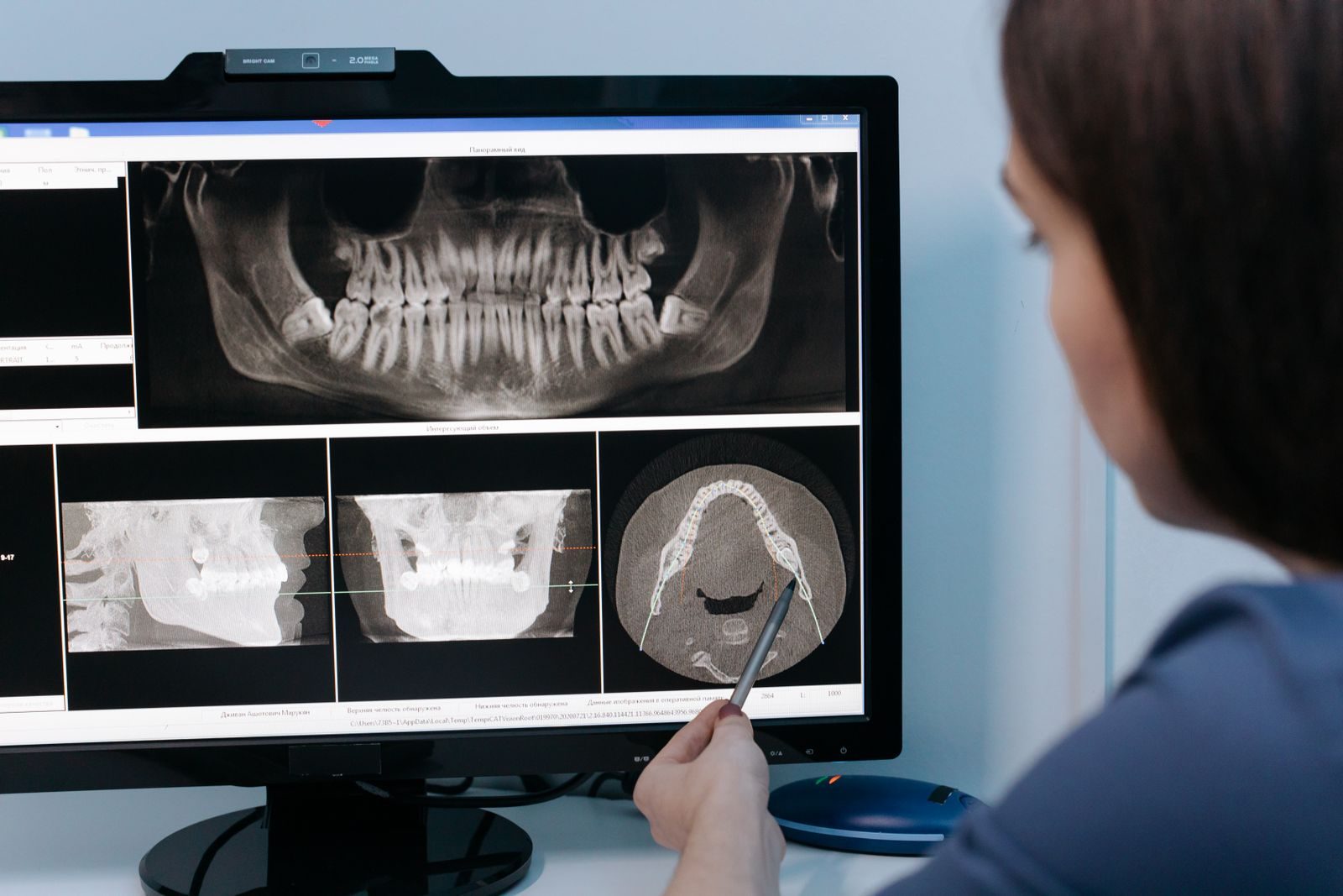 Dentiste examinant une radio panoramique sur un écran
